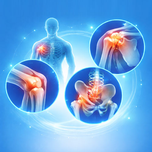 Orthopedic Medicines